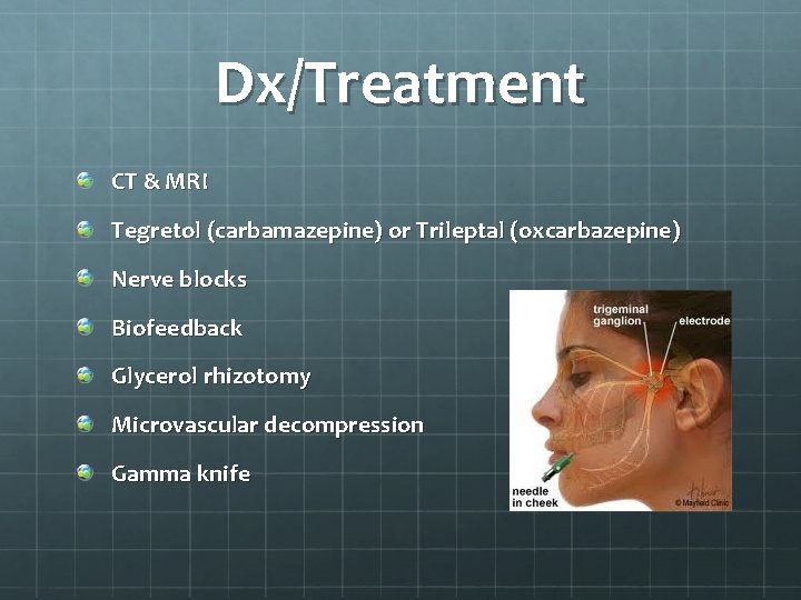 Dx/Treatment CT & MRI Tegretol (carbamazepine) or Trileptal (oxcarbazepine) Nerve blocks Biofeedback Glycerol rhizotomy