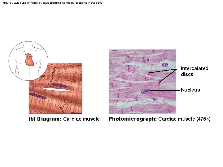 Figure 3. 20 b Type of muscle tissue and their common locations in the