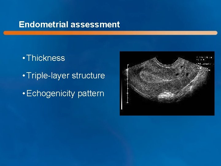 Endometrial assessment • Thickness • Triple-layer structure • Echogenicity pattern 