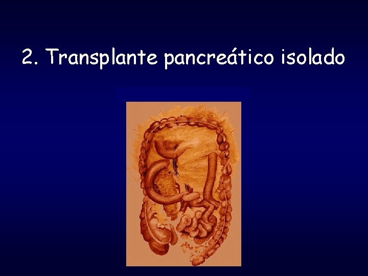 2. Transplante pancreático isolado 
