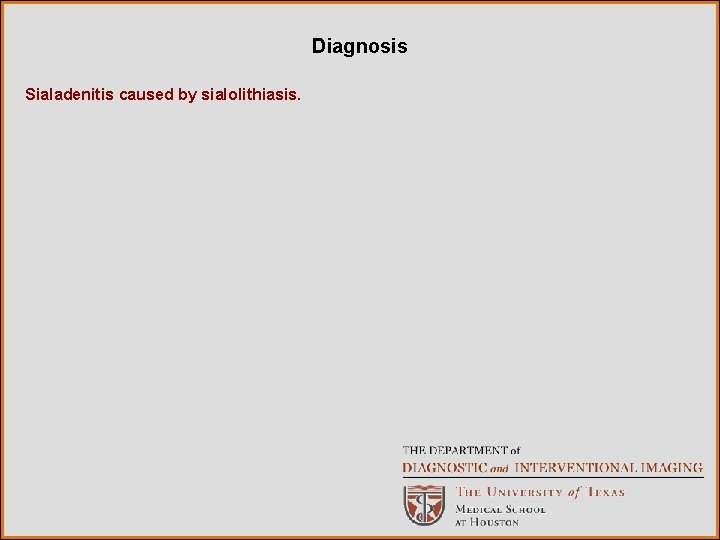 Diagnosis Sialadenitis caused by sialolithiasis. 