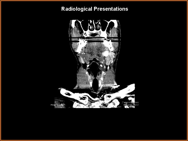 Radiological Presentations 