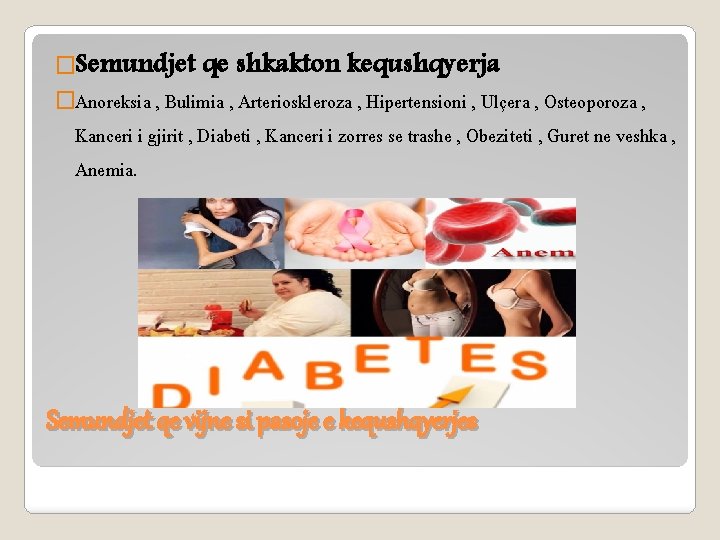 �Semundjet qe shkakton kequshqyerja �Anoreksia , Bulimia , Arterioskleroza , Hipertensioni , Ulçera ,