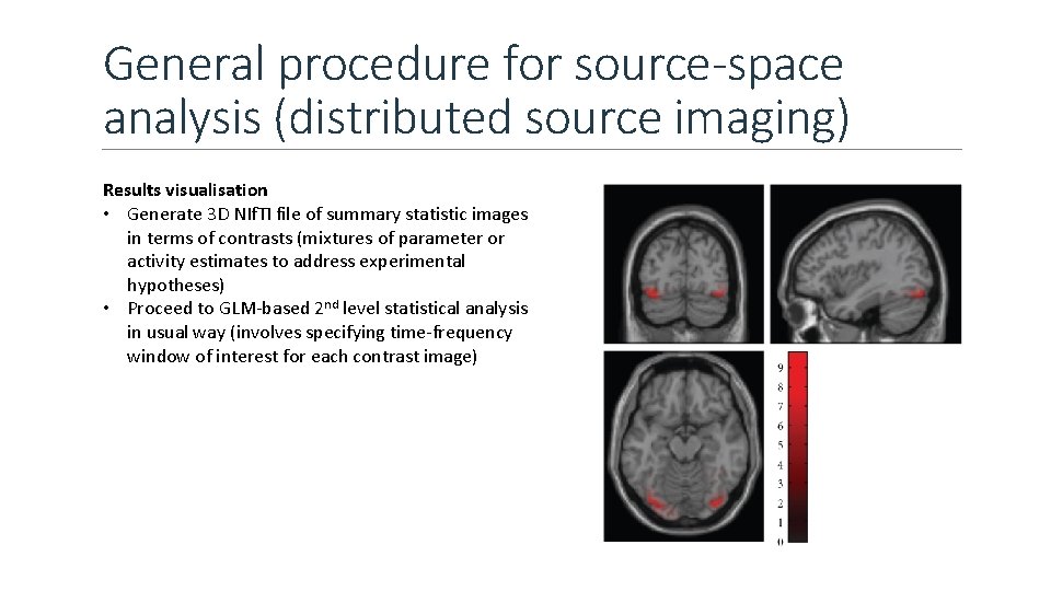 General procedure for source-space analysis (distributed source imaging) Results visualisation • Generate 3 D