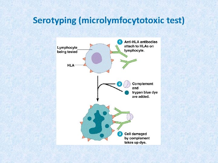 Serotyping (microlymfocytotoxic test) 