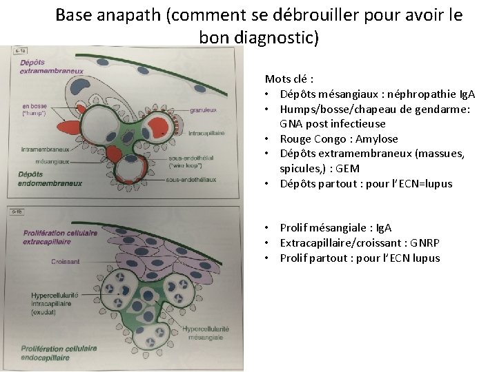 Base anapath (comment se débrouiller pour avoir le bon diagnostic) Mots clé : •