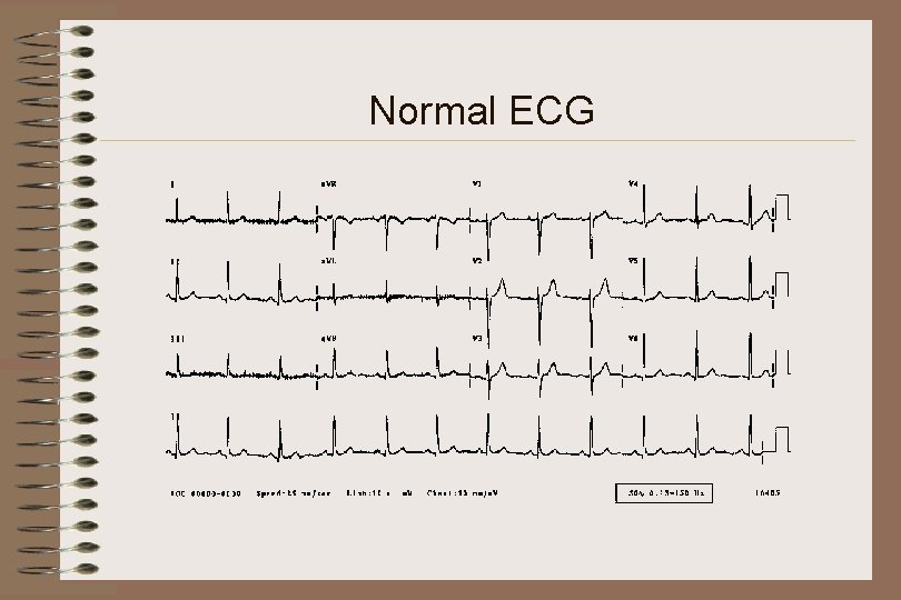 Normal ECG 