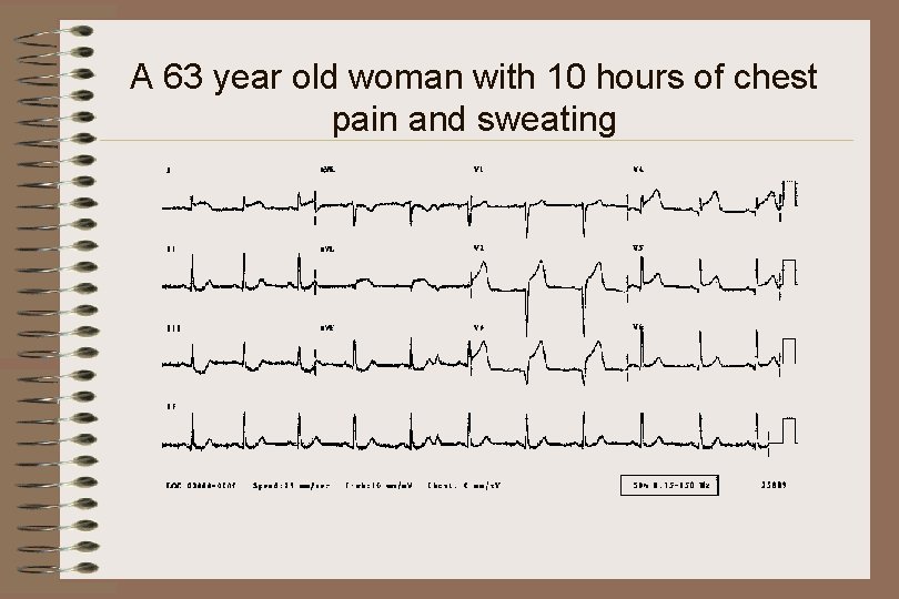 A 63 year old woman with 10 hours of chest pain and sweating 