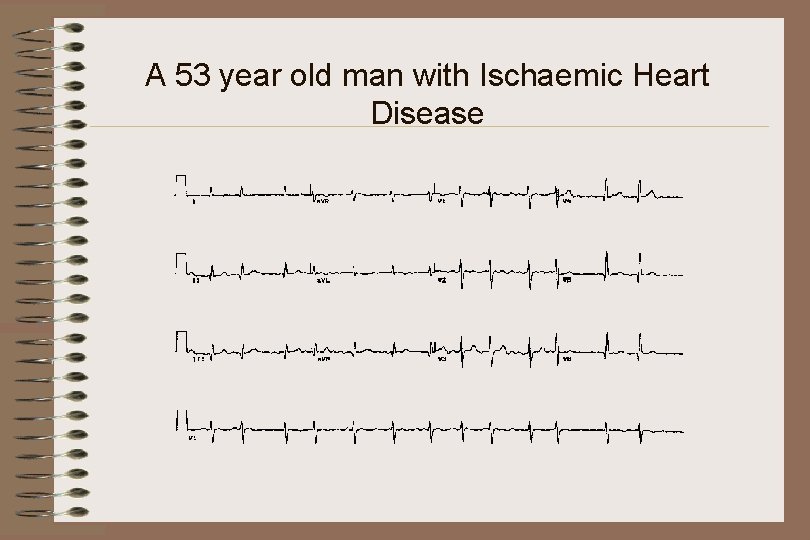 A 53 year old man with Ischaemic Heart Disease 