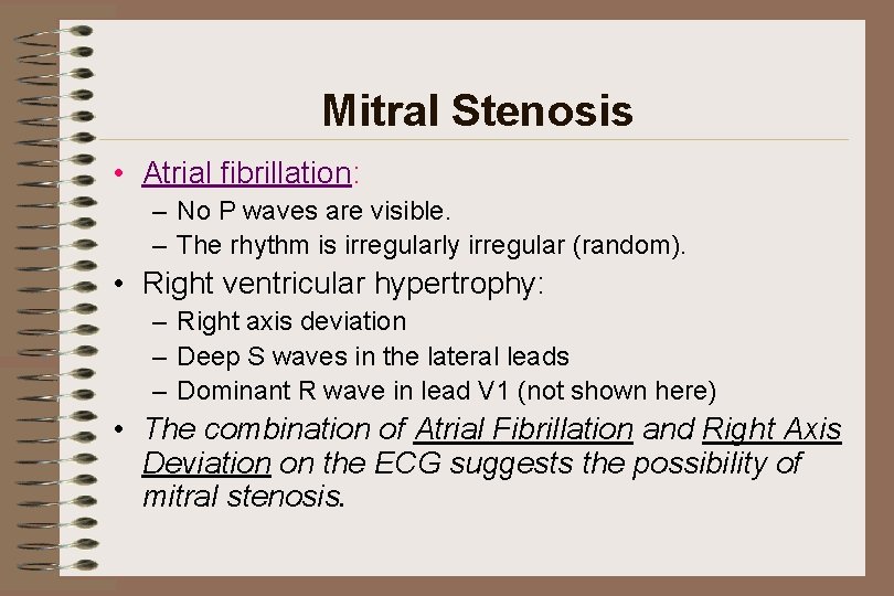 Mitral Stenosis • Atrial fibrillation: – No P waves are visible. – The rhythm