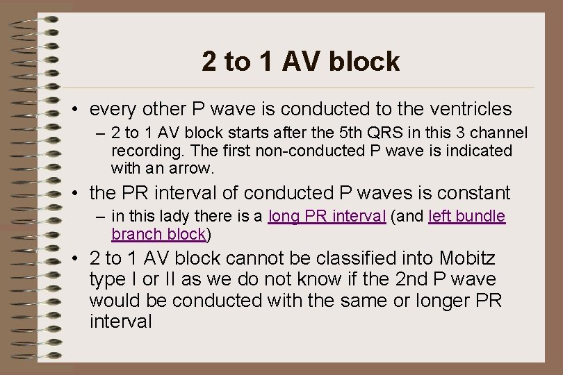 2 to 1 AV block • every other P wave is conducted to the