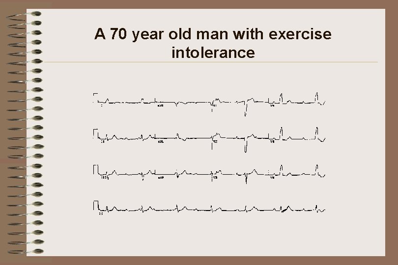 A 70 year old man with exercise intolerance 