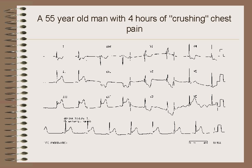 A 55 year old man with 4 hours of "crushing" chest pain 