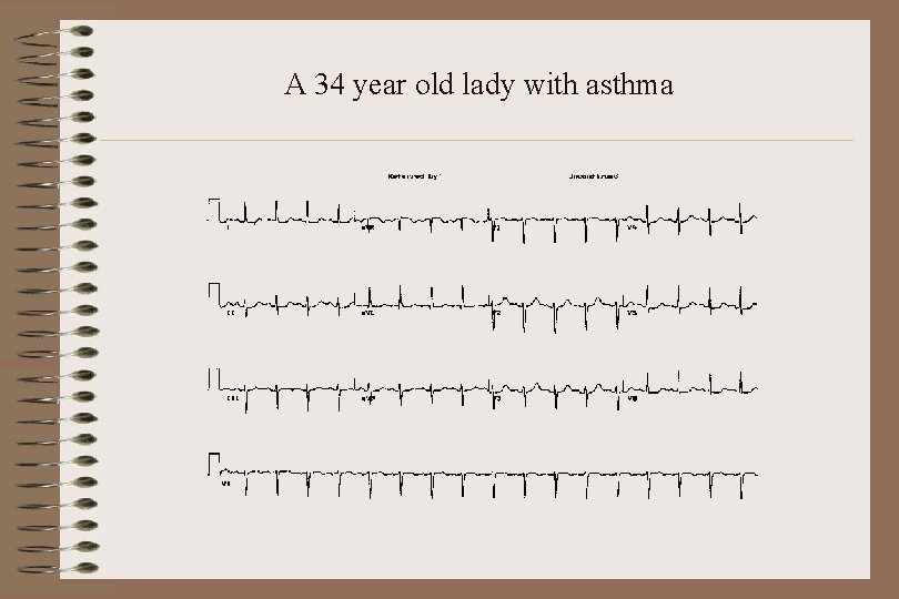 A 34 year old lady with asthma 