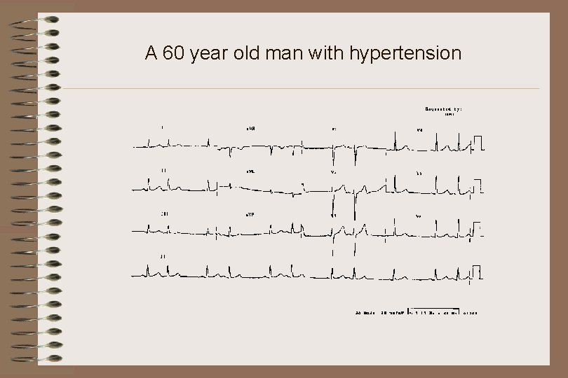 A 60 year old man with hypertension 