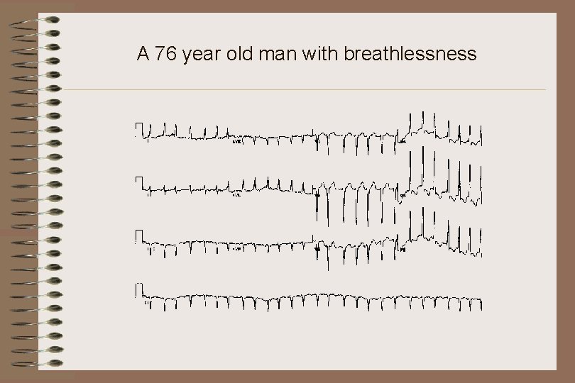 A 76 year old man with breathlessness 