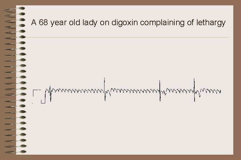 A 68 year old lady on digoxin complaining of lethargy 