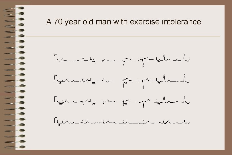 A 70 year old man with exercise intolerance 