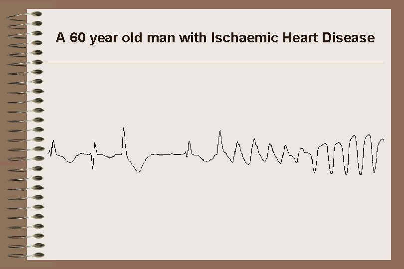A 60 year old man with Ischaemic Heart Disease 