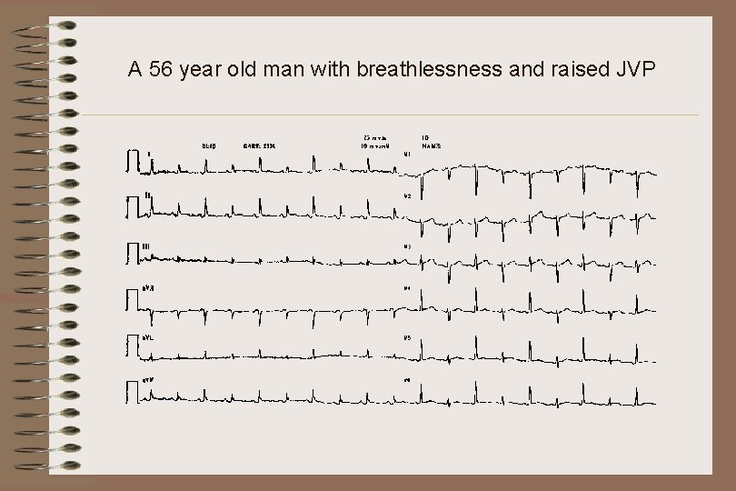 A 56 year old man with breathlessness and raised JVP 