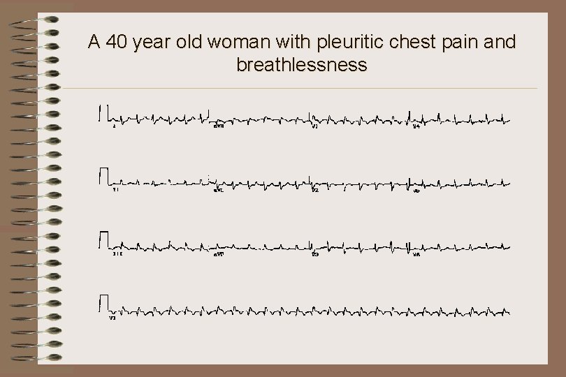 A 40 year old woman with pleuritic chest pain and breathlessness 