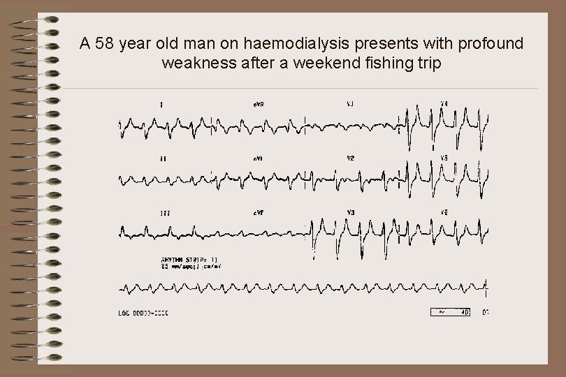 A 58 year old man on haemodialysis presents with profound weakness after a weekend