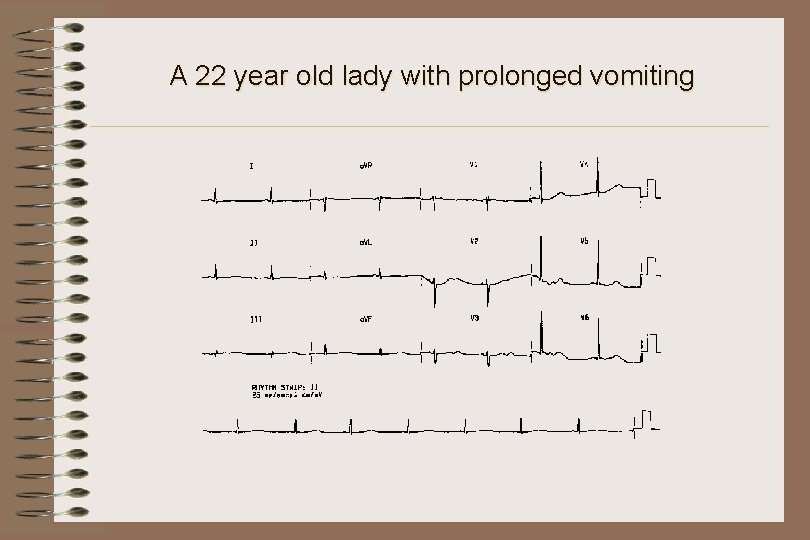 A 22 year old lady with prolonged vomiting 