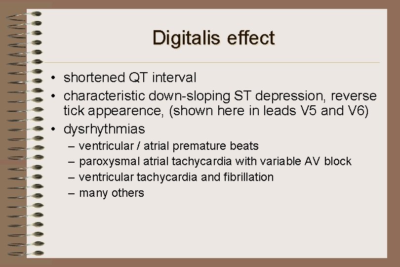 Digitalis effect • shortened QT interval • characteristic down-sloping ST depression, reverse tick appearence,