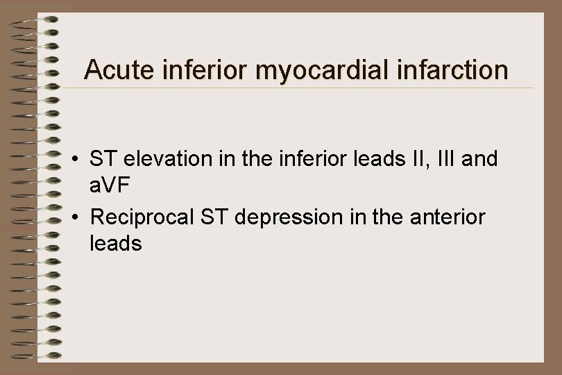 Acute inferior myocardial infarction • ST elevation in the inferior leads II, III and