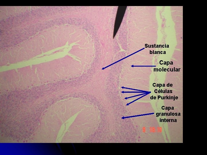 Sustancia blanca Capa molecular Capa de Células de Purkinje Capa granulosa interna 