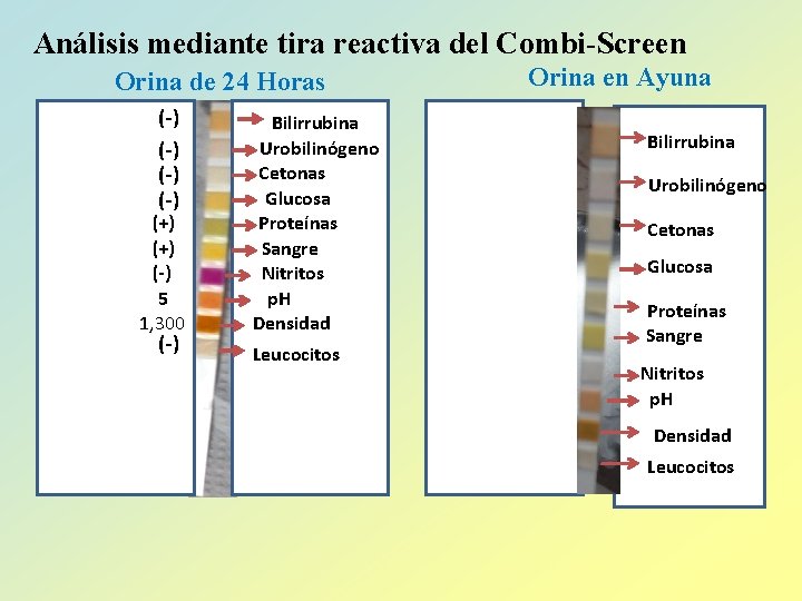 Análisis mediante tira reactiva del Combi-Screen Orina de 24 Horas (-) (-) (+) (-)