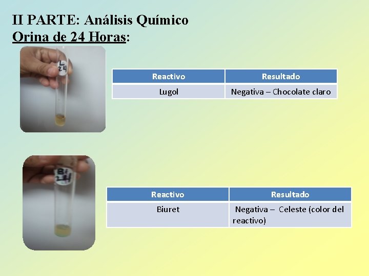 II PARTE: Análisis Químico Orina de 24 Horas: Reactivo Resultado Lugol Negativa – Chocolate