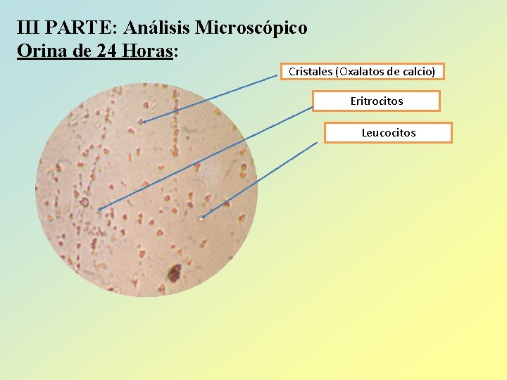 III PARTE: Análisis Microscópico Orina de 24 Horas: Cristales (Oxalatos de calcio) Eritrocitos Leucocitos