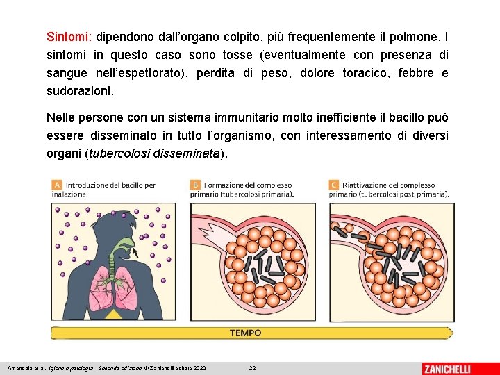 Sintomi: dipendono dall’organo colpito, più frequentemente il polmone. I sintomi in questo caso sono