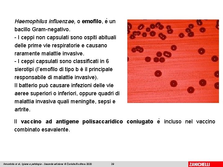 Haemophilus influenzae, o emofilo, e un bacillo Gram-negativo. - I ceppi non capsulati sono