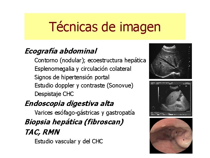 Técnicas de imagen Ecografía abdominal Contorno (nodular); ecoestructura hepática Esplenomegalia y circulación colateral Signos