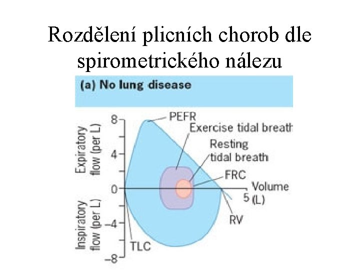 Rozdělení plicních chorob dle spirometrického nálezu 