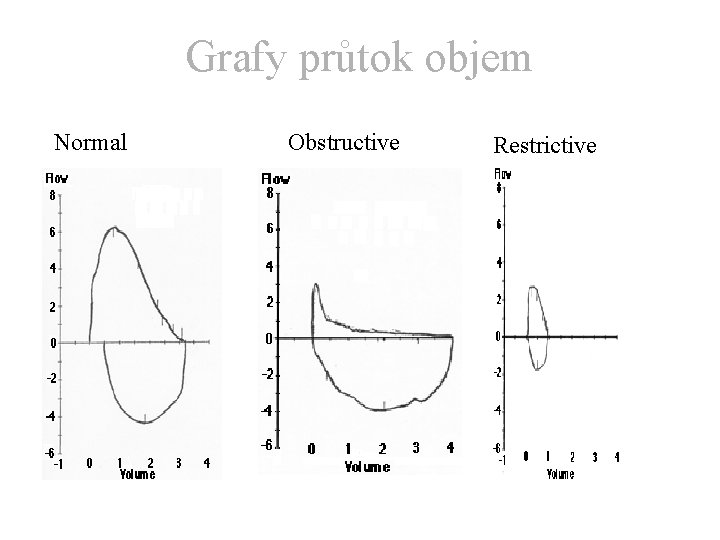 Grafy průtok objem Normal Obstructive Restrictive 