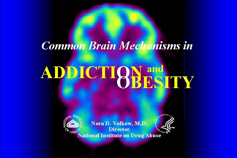 Common Brain Mechanisms in ADDICTION OBESITY and Nora D. Volkow, M. D. Director National