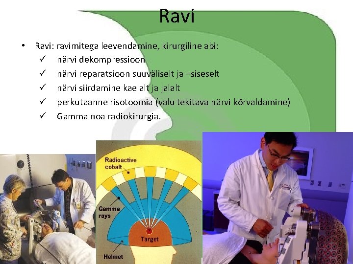 Ravi • Ravi: ravimitega leevendamine, kirurgiline abi: ü närvi dekompressioon ü närvi reparatsioon suuväliselt