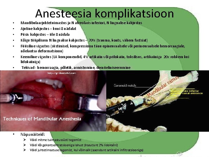 Anesteesia komplikatsioon • Mandibulaarjuhtetuimastus ja N alveolaris inferiori, N lingualise kahjustus Ajutine kahjustus –