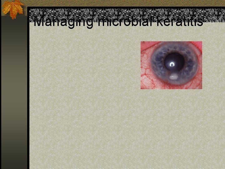 Managing microbial keratitis 