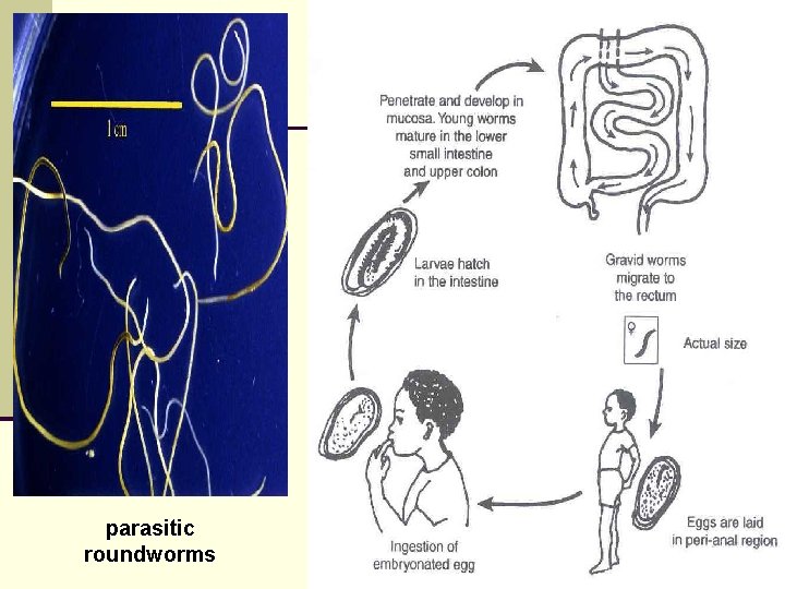 parasitic roundworms 