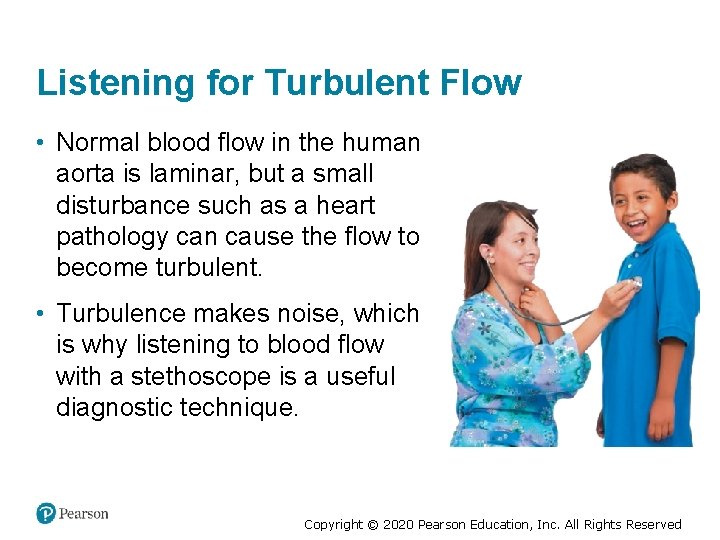 Listening for Turbulent Flow • Normal blood flow in the human aorta is laminar,