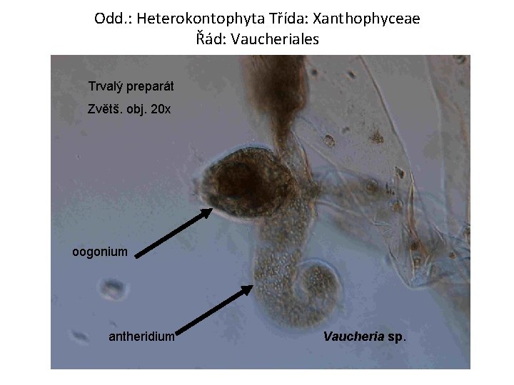 Odd. : Heterokontophyta Třída: Xanthophyceae Řád: Vaucheriales Trvalý preparát Zvětš. obj. 20 x oogonium