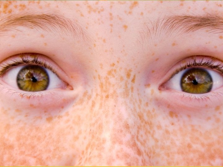 Freckle Juice By Judy Blume 