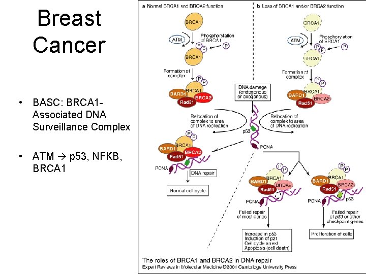 Breast Cancer • BASC: BRCA 1 Associated DNA Surveillance Complex • ATM p 53,