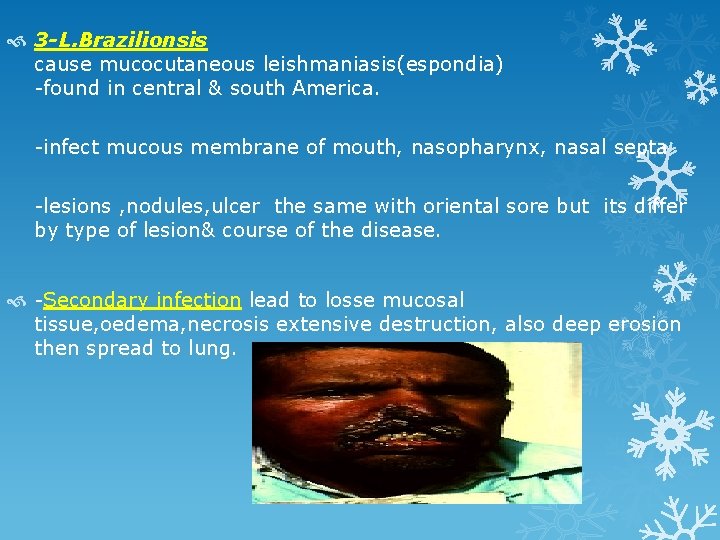  3 -L. Brazilionsis cause mucocutaneous leishmaniasis(espondia) -found in central & south America. -infect