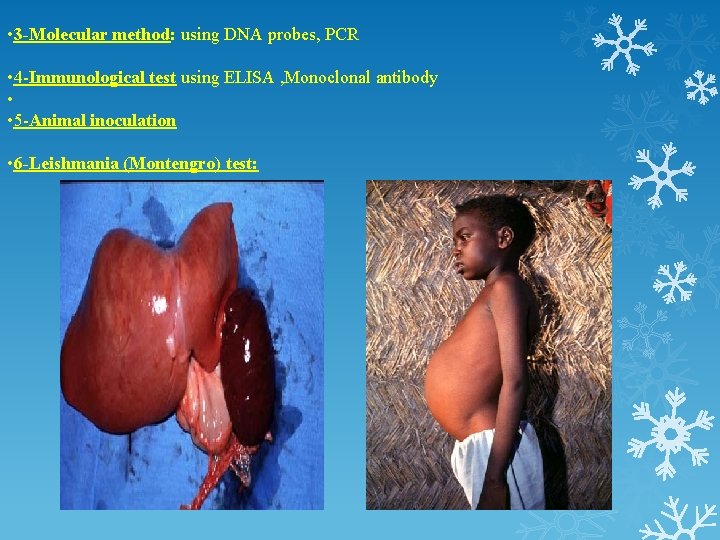  • 3 -Molecular method: using DNA probes, PCR • 4 -Immunological test using