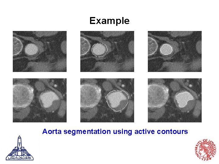 Example Aorta segmentation using active contours 